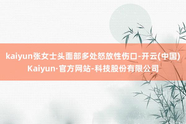 kaiyun张女士头面部多处怒放性伤口-开云(中国)Kaiyun·官方网站-科技股份有限公司